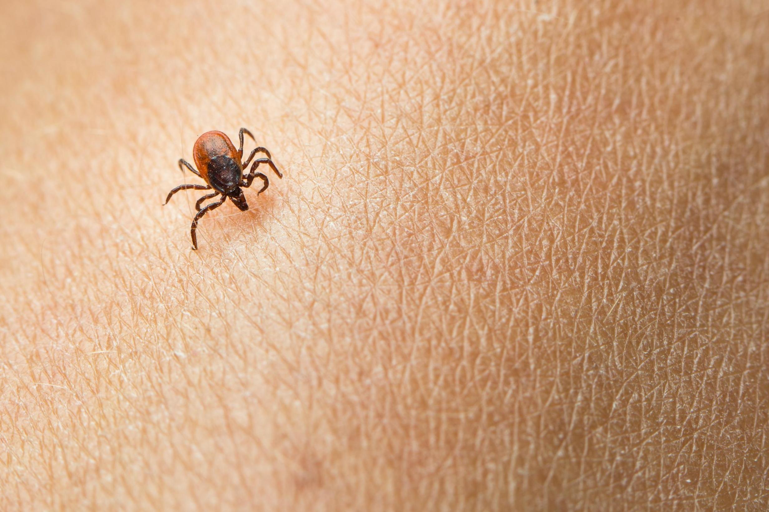 A man learned his eye discomfort was caused by a tick