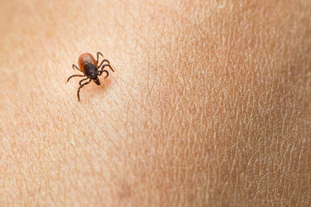 A man learned his eye discomfort was caused by a tick 