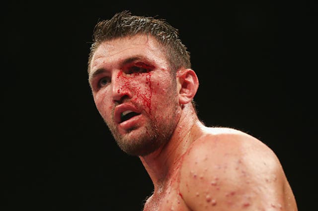 Hughie Fury has a professional record of 23-2