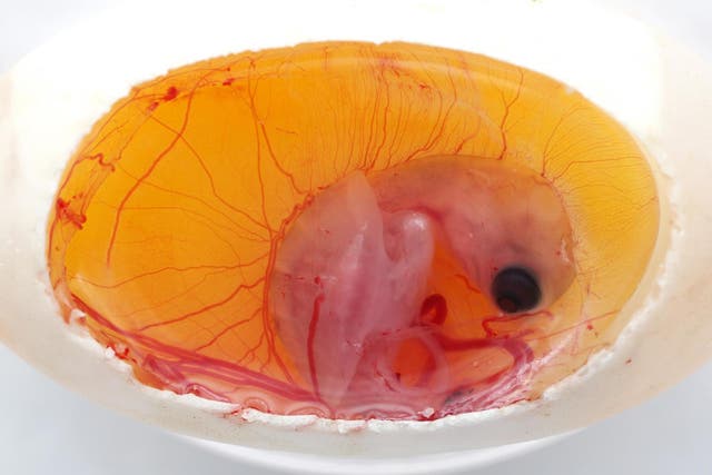 A single embryo (pictured) could experience temperature differences of up to 4.7C