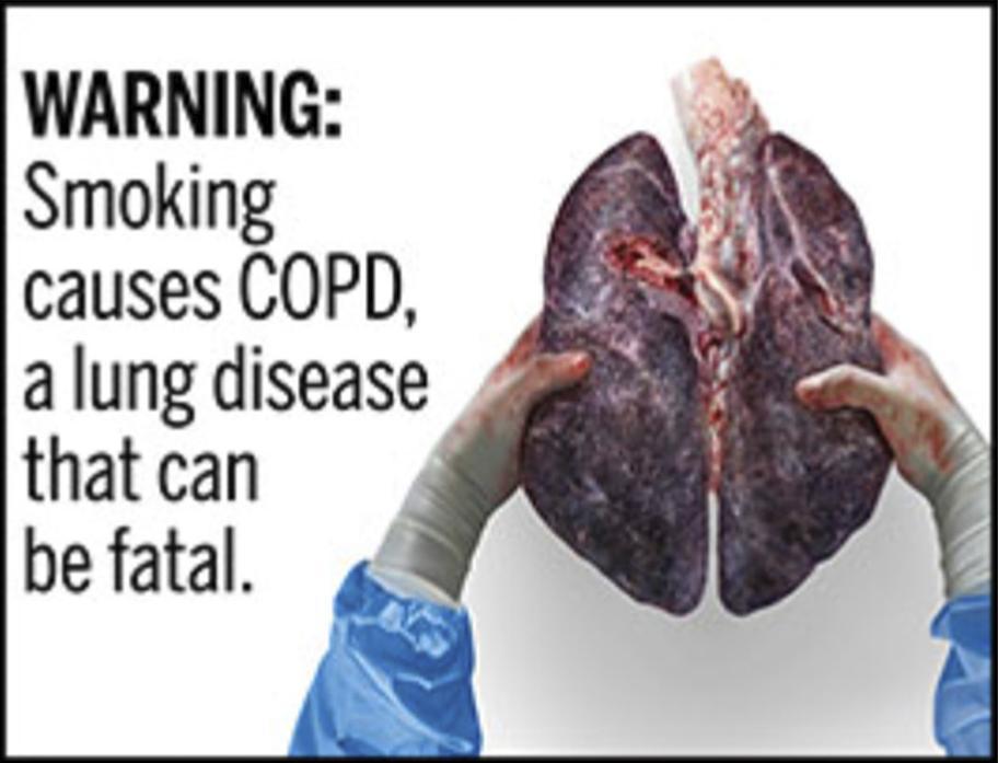images of damaged lungs due to smoking