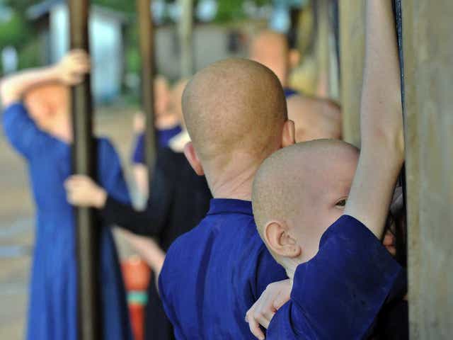 Albinos have previously been targeted for their body parts