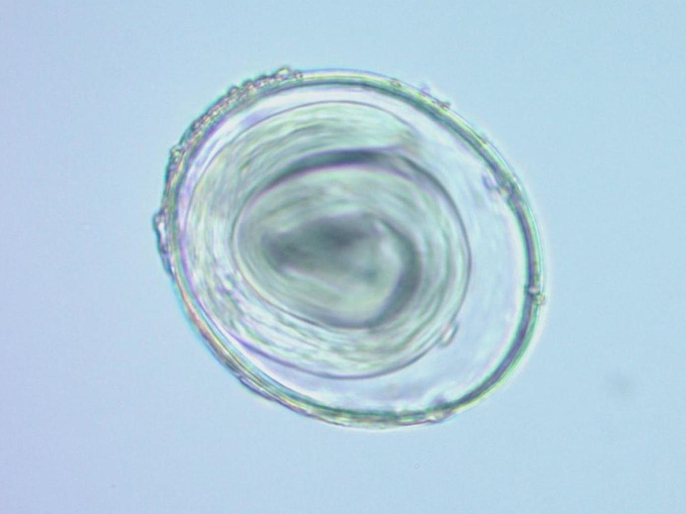The eggs (pictured, 400× magnification) belonged to a species of roundworm which is still commonly found in the digestive systems of modern day cats, dogs and foxes (Romina S Petrigh, Jorge G Martínez, Mariana Mondini and Martín H Fugassa. Parasitology)