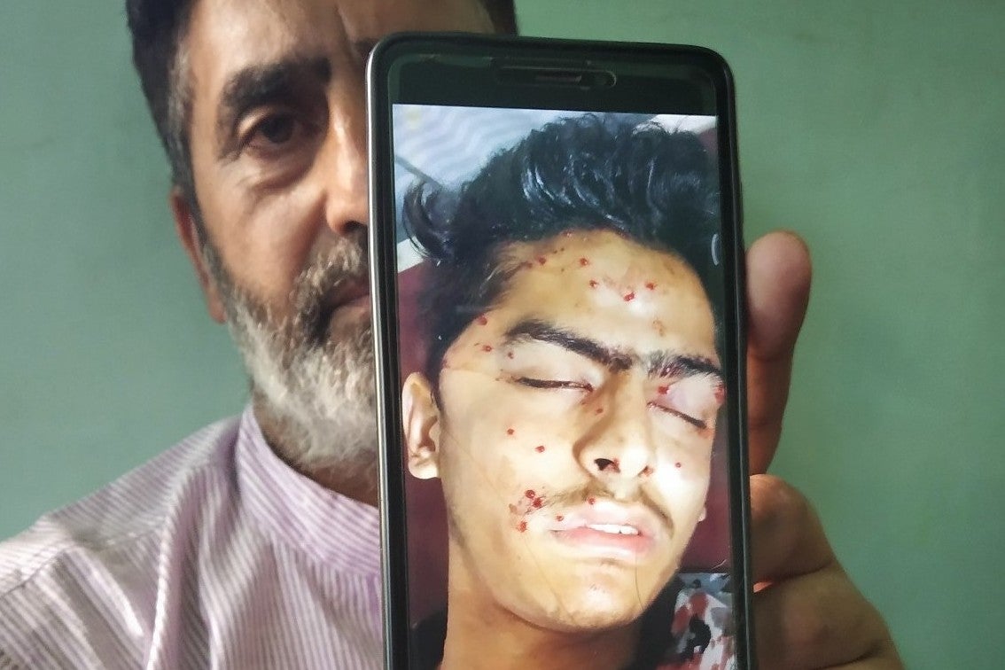 Firdous Ahmed with a picture of his son shortly after he was admitted to hospital on 6 August
