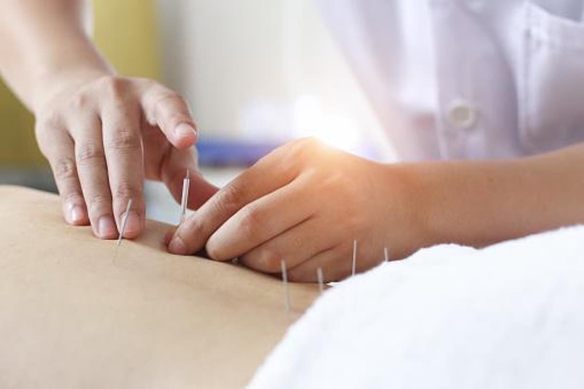 Acupuncturist punctures patient's lungs after inserting needles too deep |  The Independent | The Independent