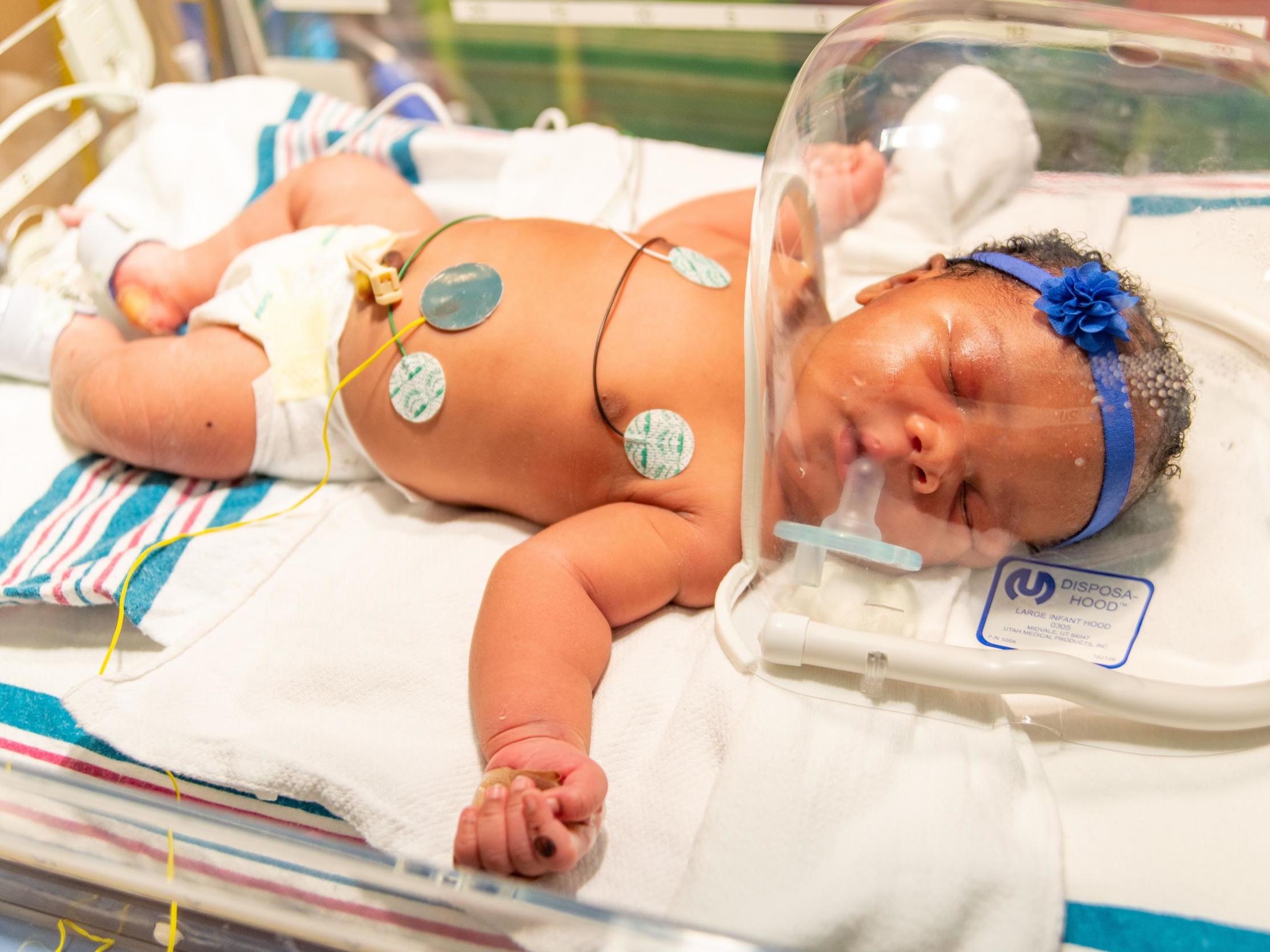 Staff at Methodist Le Bonheur Hospital were left surprised by the rare event