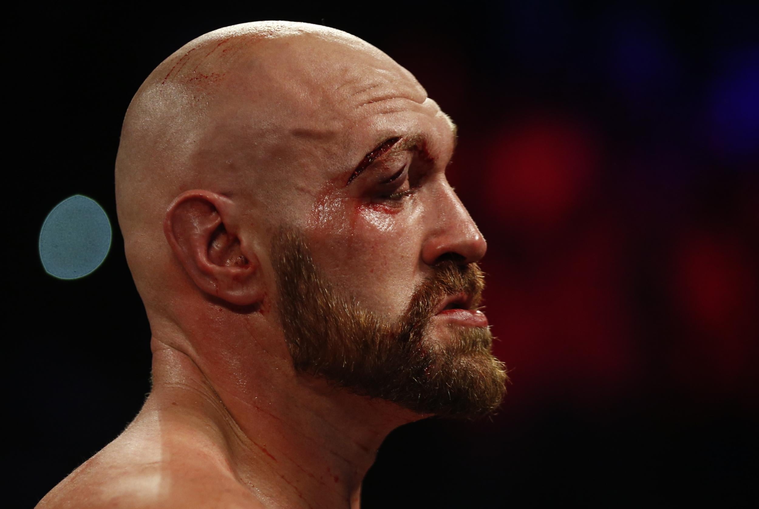 Fury suffered two deep cuts to the eye in the second round