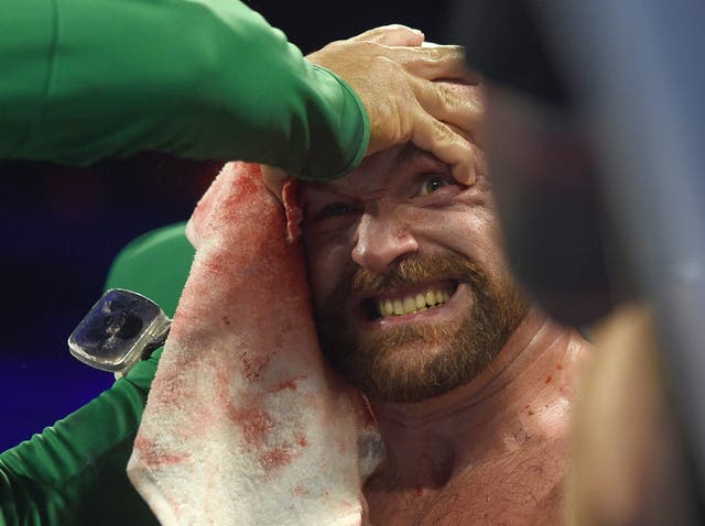 Tyson Fury was taken to hospital after his win
