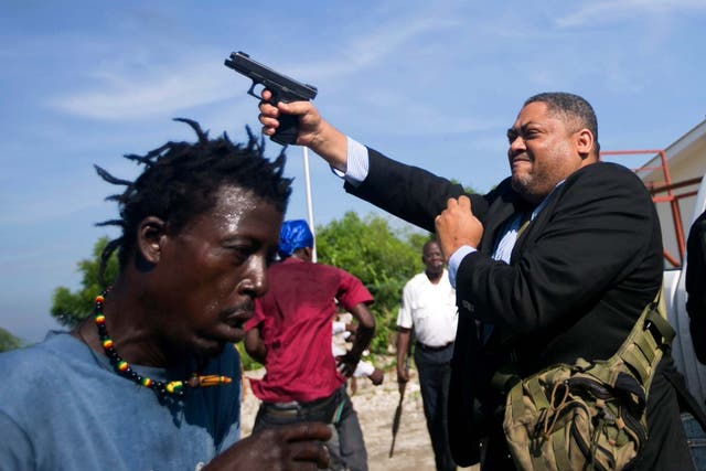 Photo taken by man who is to reportedly have bullet fragments removed from his face after being shot by a Haitian senator