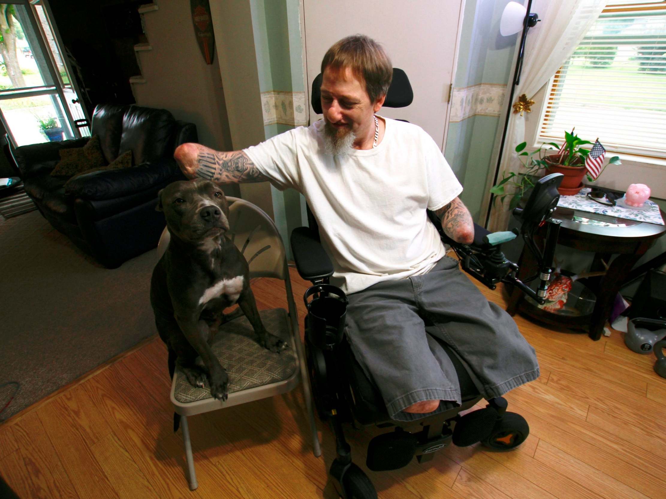 Greg Manteufel pets his dog Ellie, who may have caused a rare illness that cost him parts of his arms, legs and face