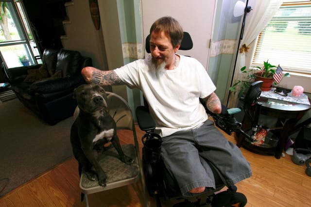 Greg Manteufel pets his dog Ellie, who may have caused a rare illness that cost him parts of his arms, legs and face