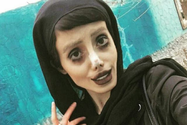 Sahar Tabar posted images of herself on Instagram claiming to have had plastic surgery to look like actress Angelina Jolie.