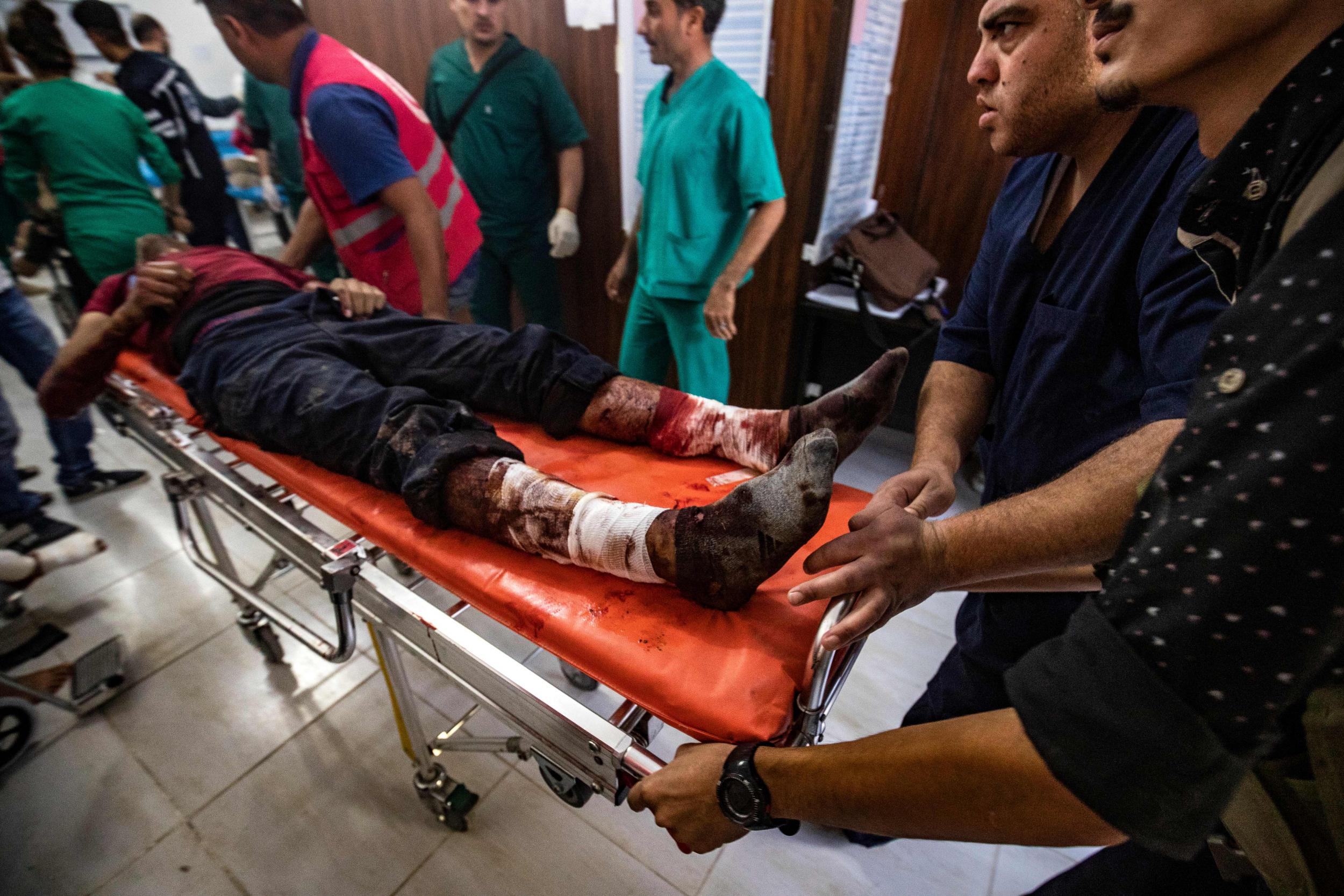 The injured are rushed to a hospital in Tal Tamr during the Turkish offensive against Kurdish-controlled areas of northeastern Syria