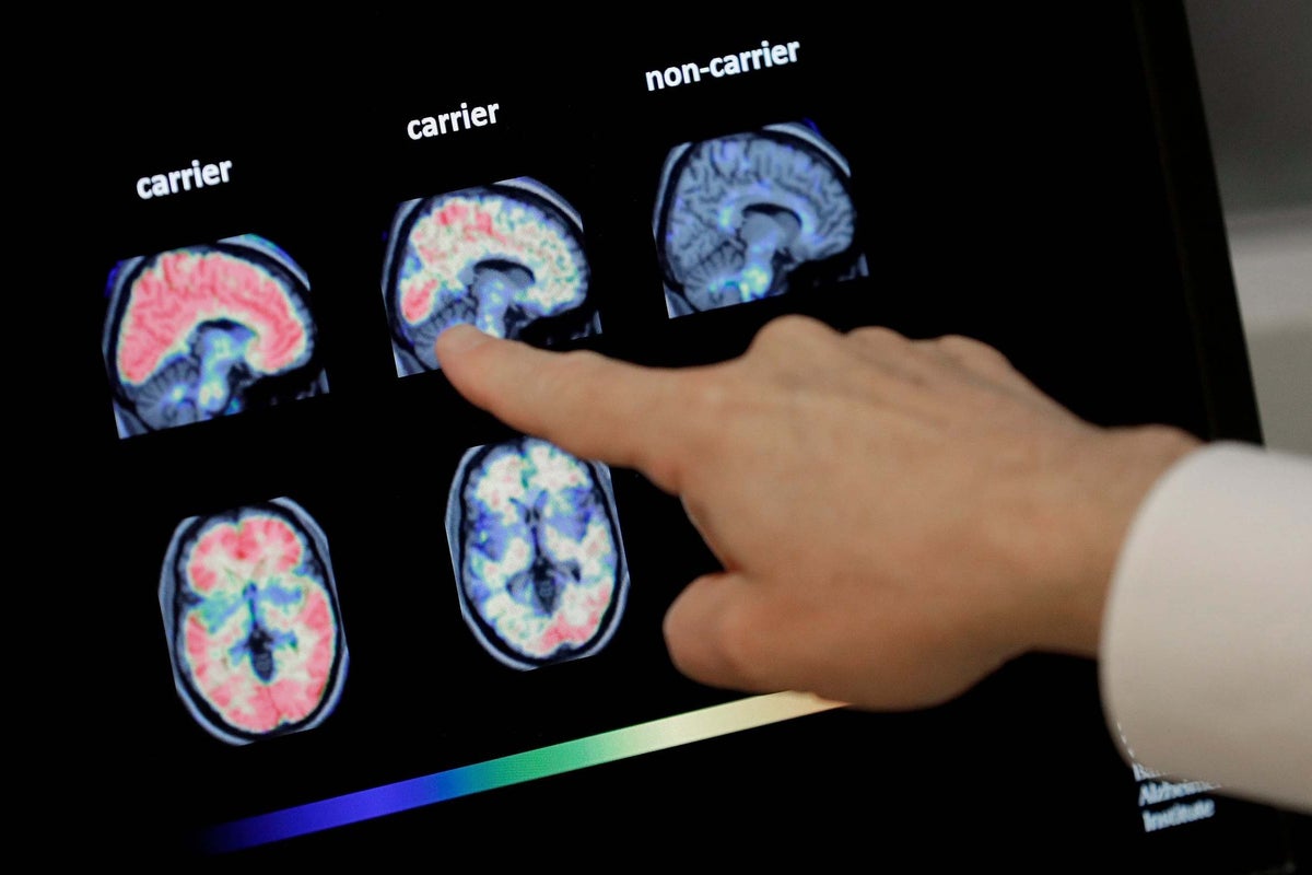 https://static.independent.co.uk/s3fs-public/thumbnails/image/2019/10/23/00/alzheimer's-drug.jpg?width=1200&height=800&crop=1200:800
