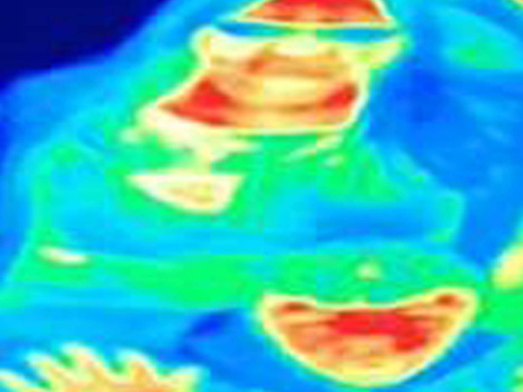 Premium Vector  Thermography of female chest thermographic image of breast