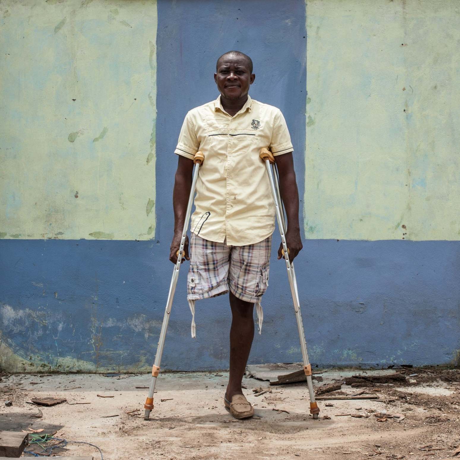 Amarachi Onyemaechi lost a leg during a pro-Biafra protest in 2015