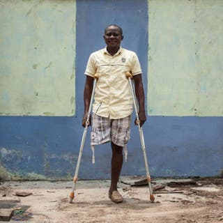 Amarachi Onyemaechi lost a leg during a pro-Biafra protest in 2015