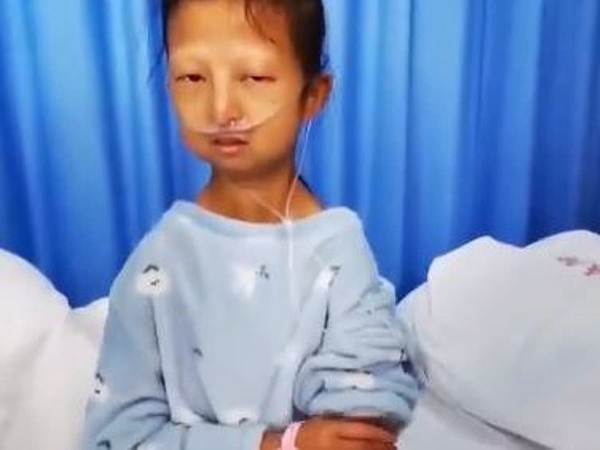 Malnourished student dies in China, weighing only 21kg after being unable to afford food