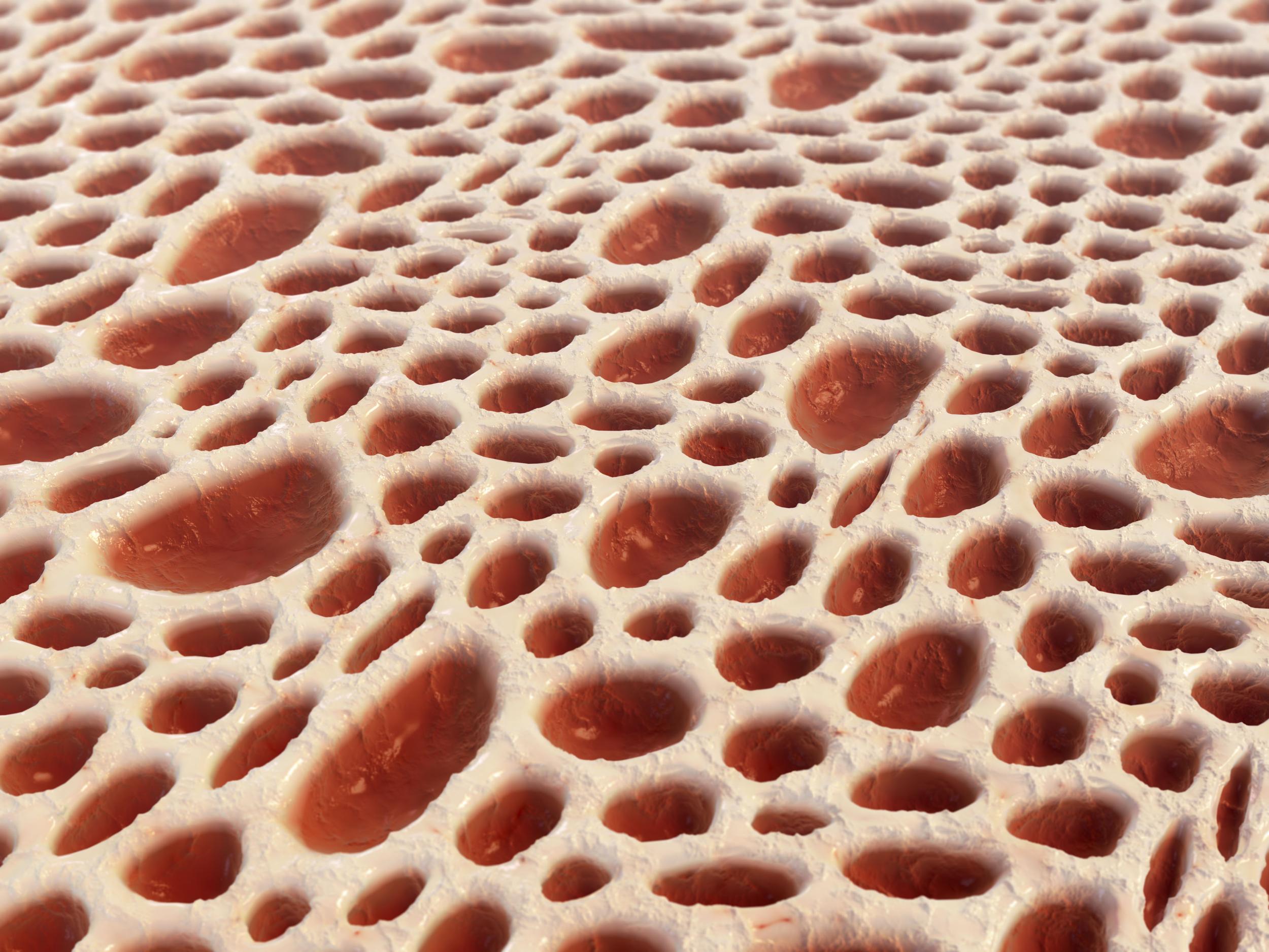 The interior of our bones is sponge-like in appearance, and surrounds red bone marrow
