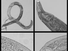 Parasitic worms found in woman’s eye sparking ‘emerging’ disease fears