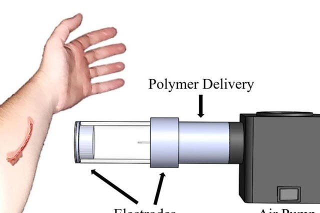 The device (artist’s impression) uses air to spray fibres (polymer) onto the surface of the skin, similar to a can of spray paint