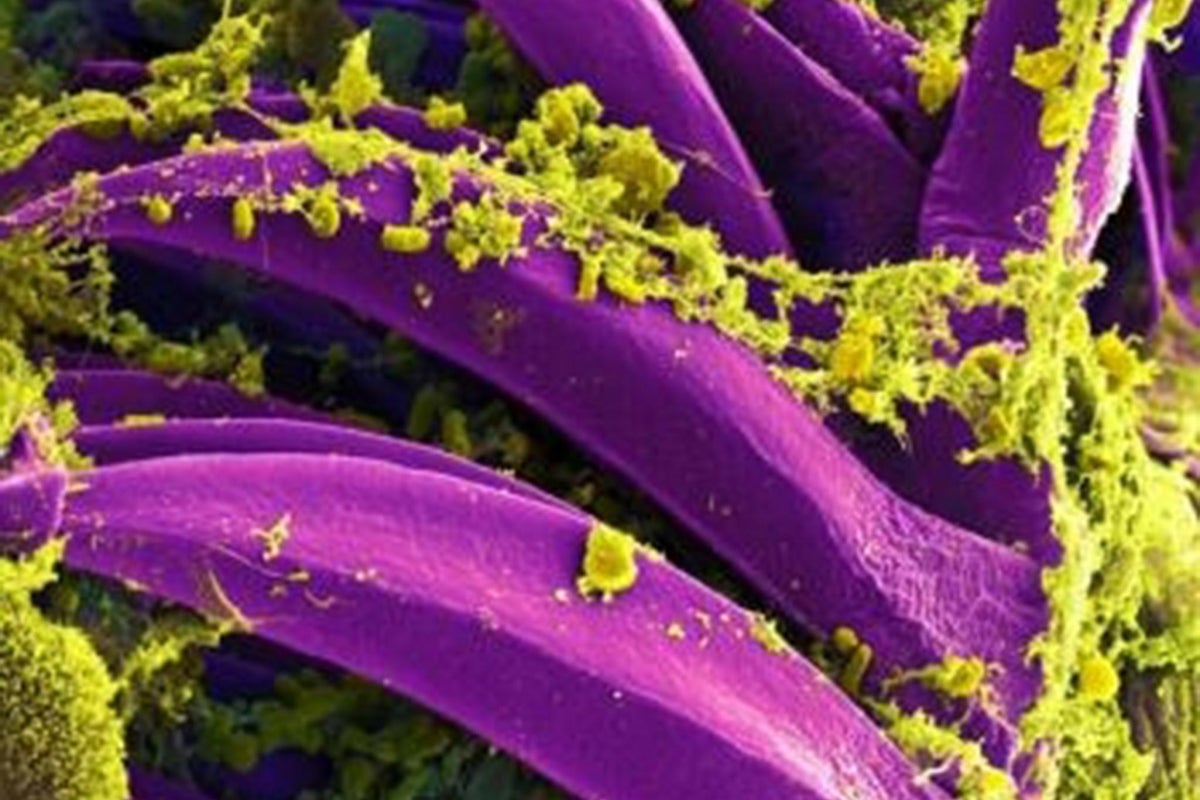 What we know about the US resident who died from the plague