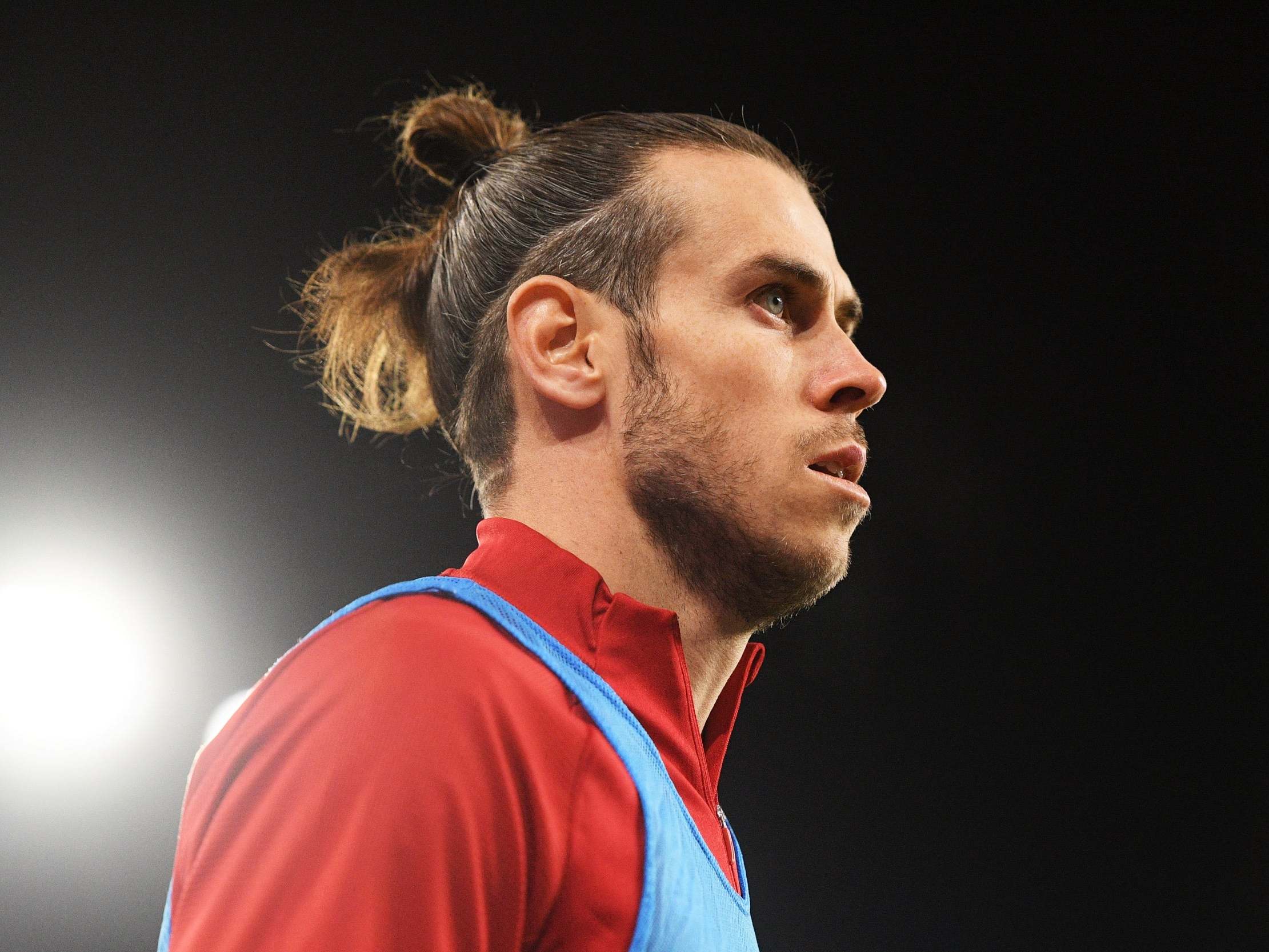 Gareth Bale's Hair Transplant | Longevita