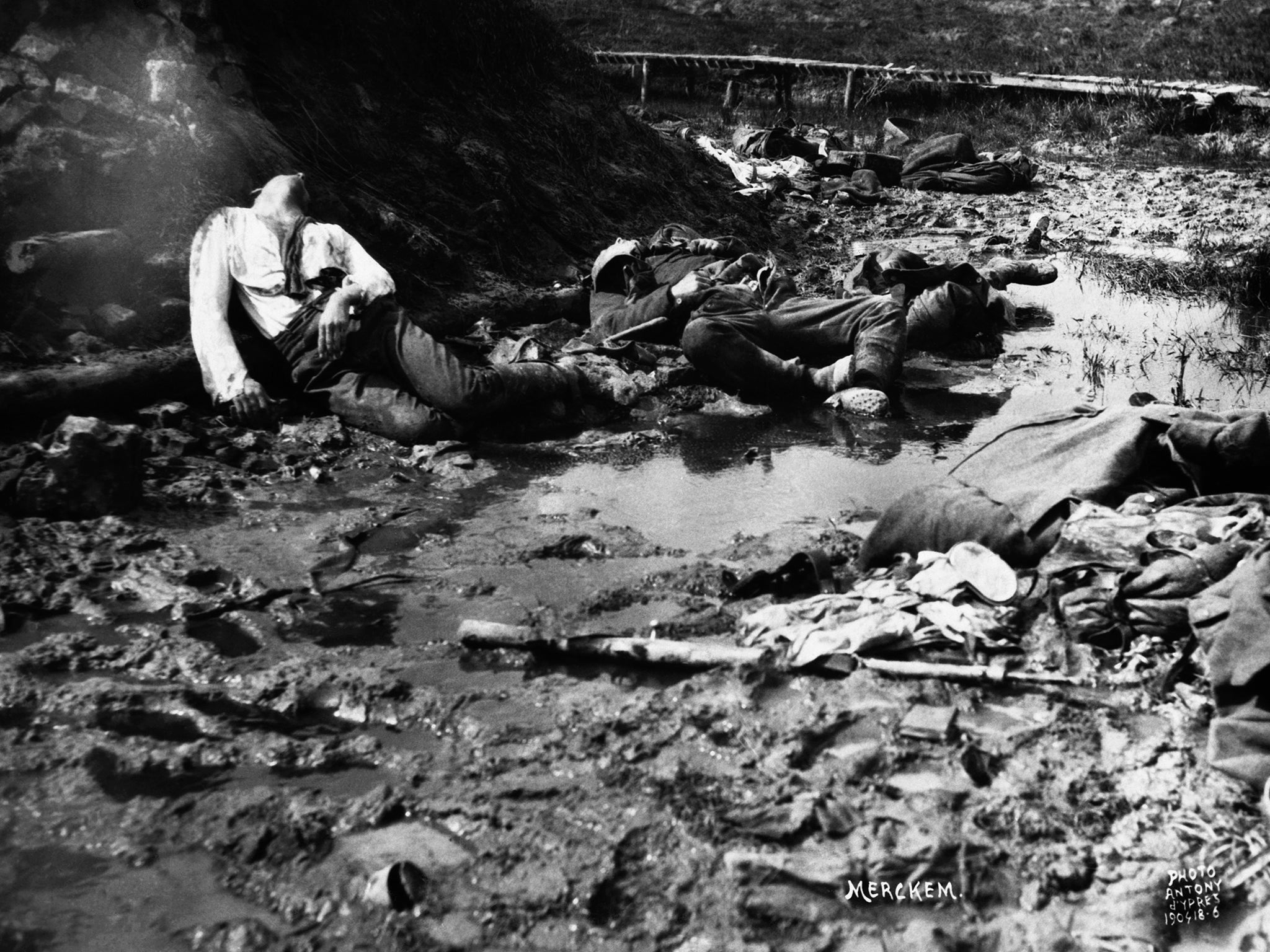 The first battle of Ypres: soldiers who returned home after the First World War suffered with shell shock, the name then given to PTSD