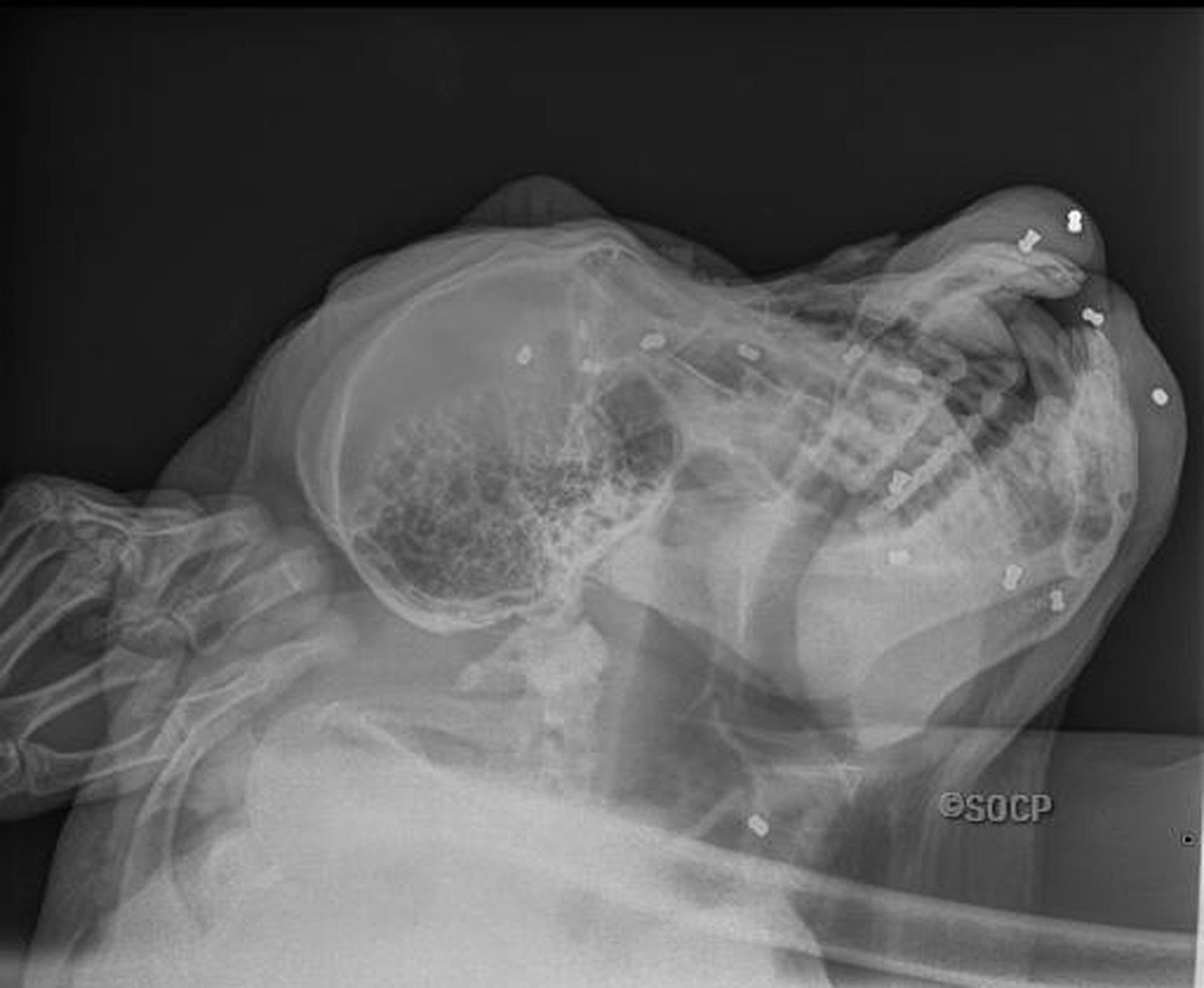 An X-ray image of shows the air rifle pellets in the head of Paguh, a Sumatran orangutan