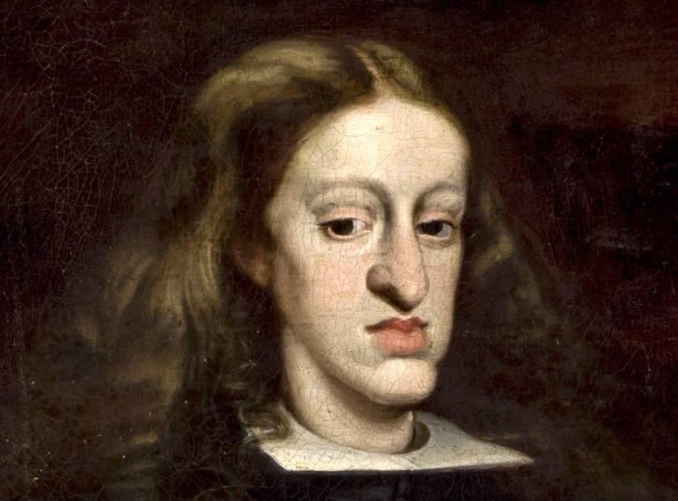A portrait by Juan Carreno de Miranda of Charles II, the last of the Habsburg line, shows the Spanish's king facial deformity