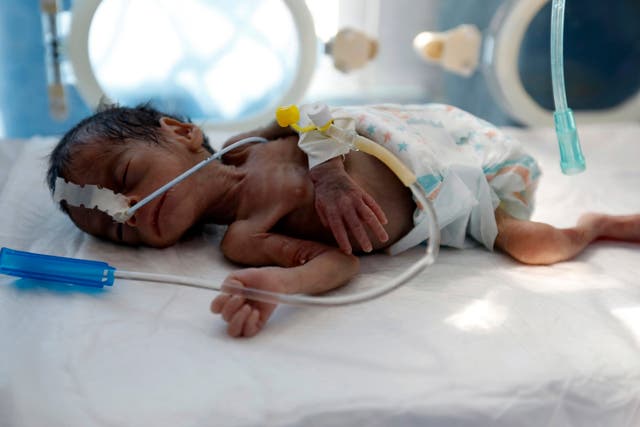 A malnourished baby lies in an incubator in the neonatal intensive care unit of a hospital in Sana'a, Yemen