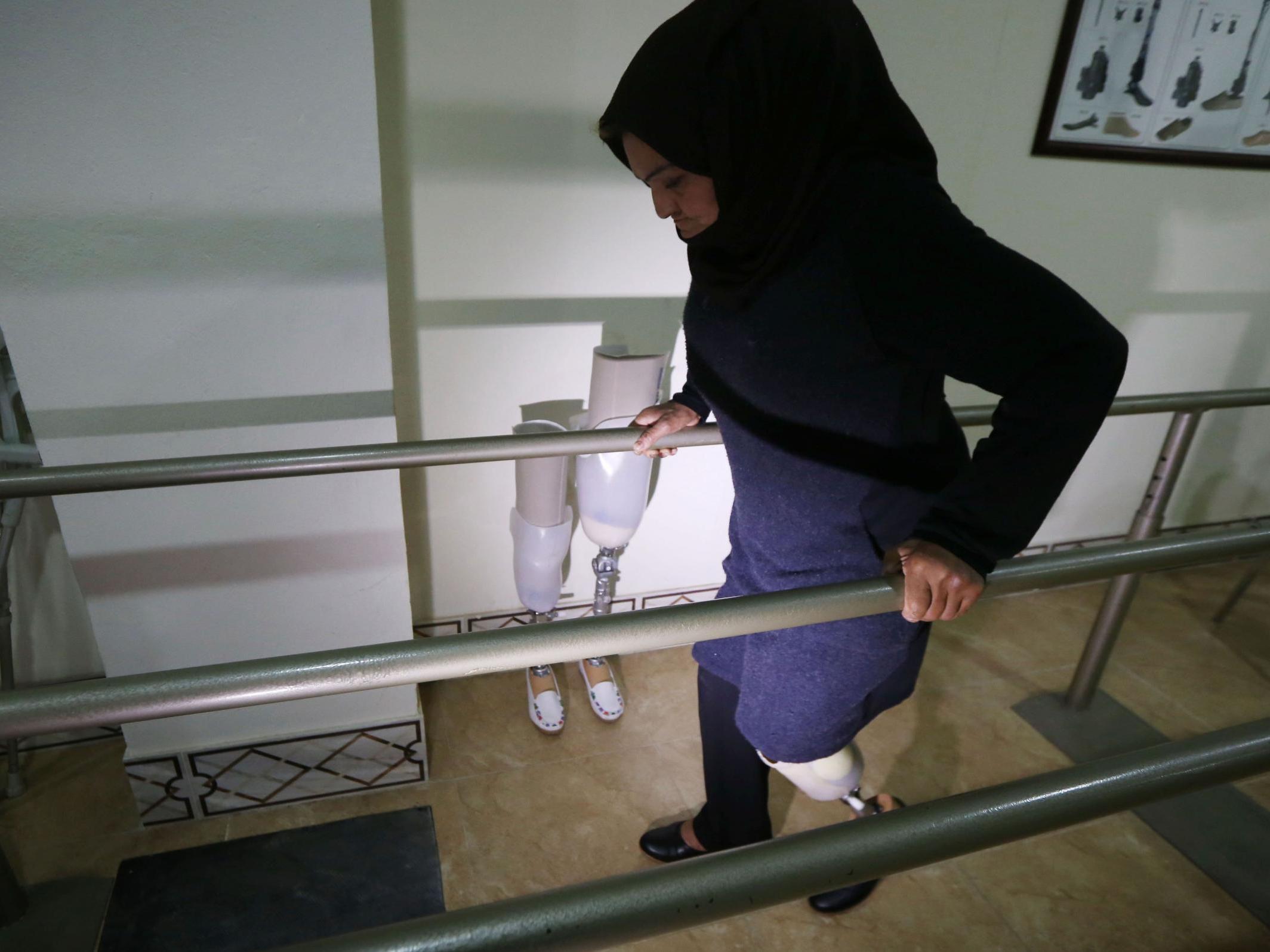 Nofa Mohammed, a 45-year-old Iraqi woman from Mosul who lost her leg in a 2016 attack by Isis fighters, tries a prosthetic leg