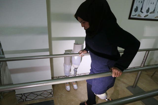 Nofa Mohammed, a 45-year-old Iraqi woman from Mosul who lost her leg in a 2016 attack by Isis fighters, tries a prosthetic leg
