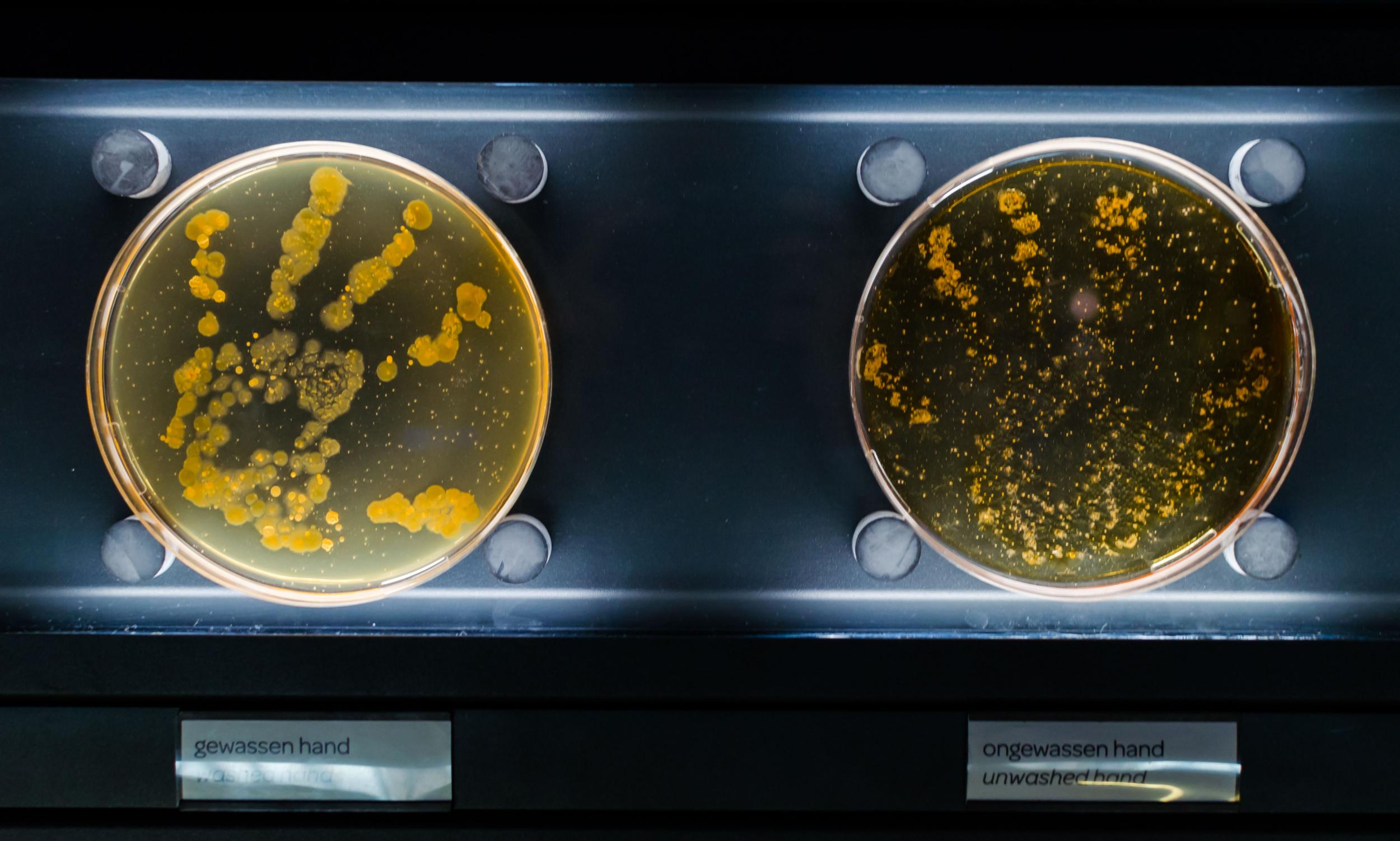 Bacteria from a washed and unwashed hand in petri dishes