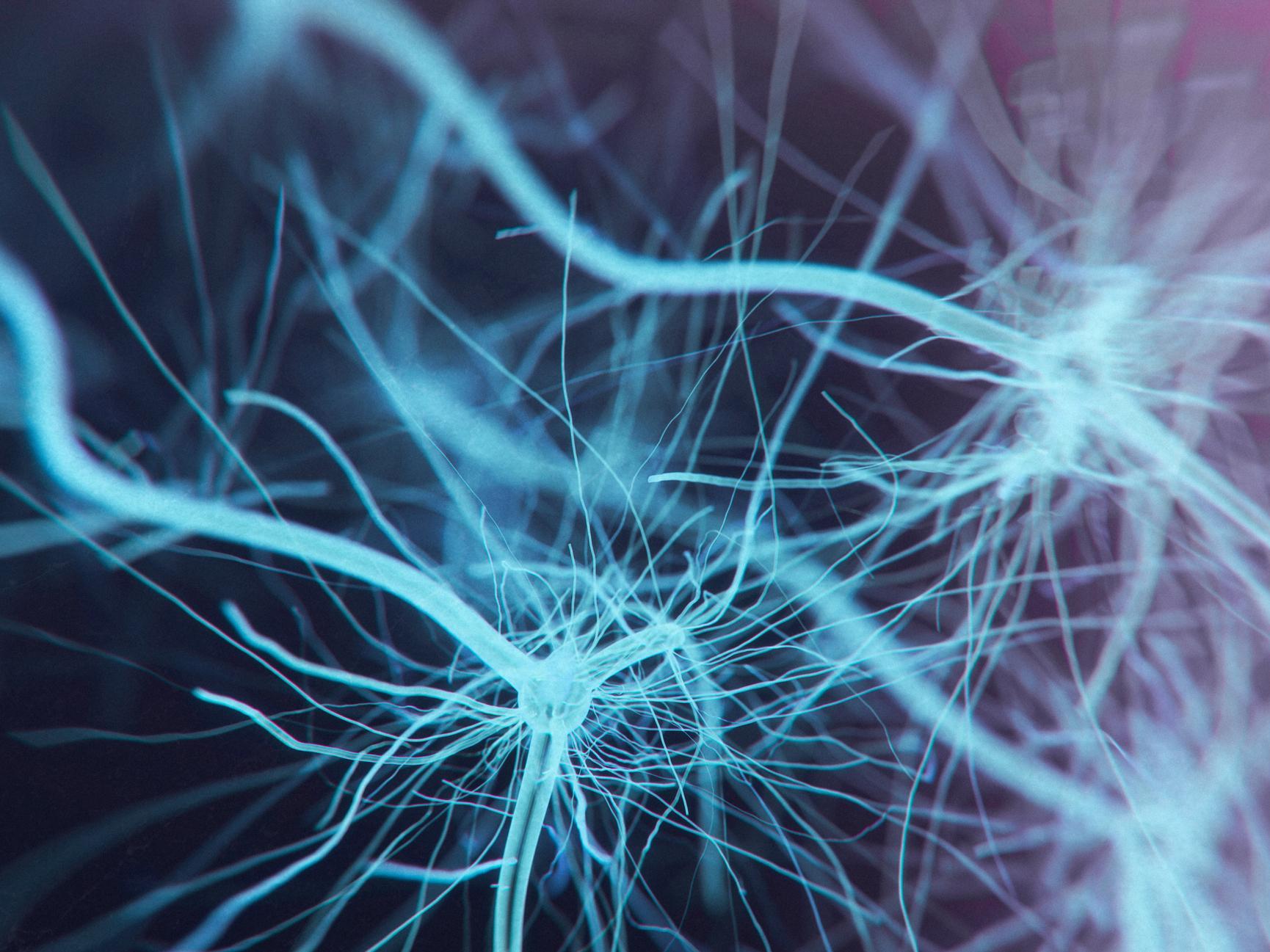Motor Neurone Disease linked to cholesterol in new research