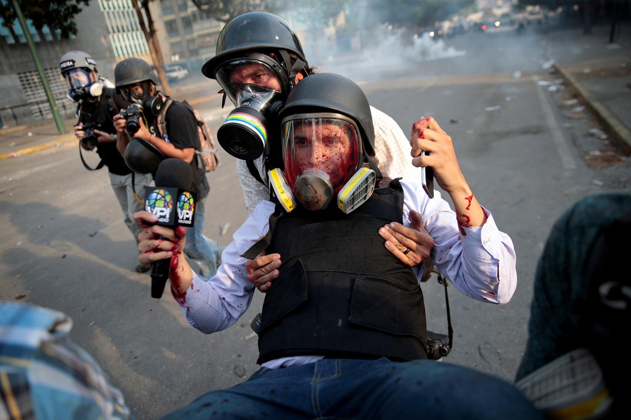 Journalist Gregory Jaimes was injured during protests in Caracas Reuters)