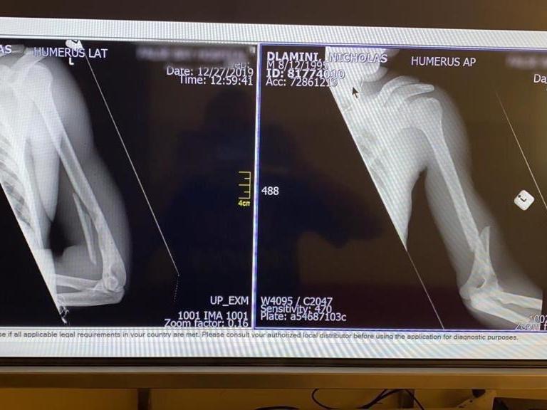 Nicholas Dlamini: South African cyclist suffers broken arm during arrest in Table Mountain National Park