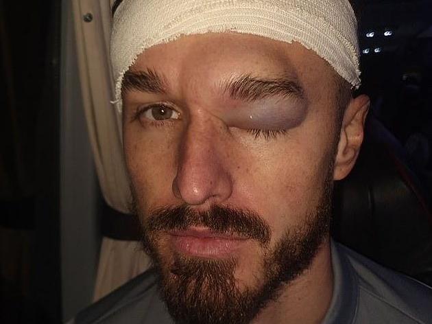 Cardiff City defender Joe Bennett reveals gruesome eye injury after clashing with Junior Hoilett