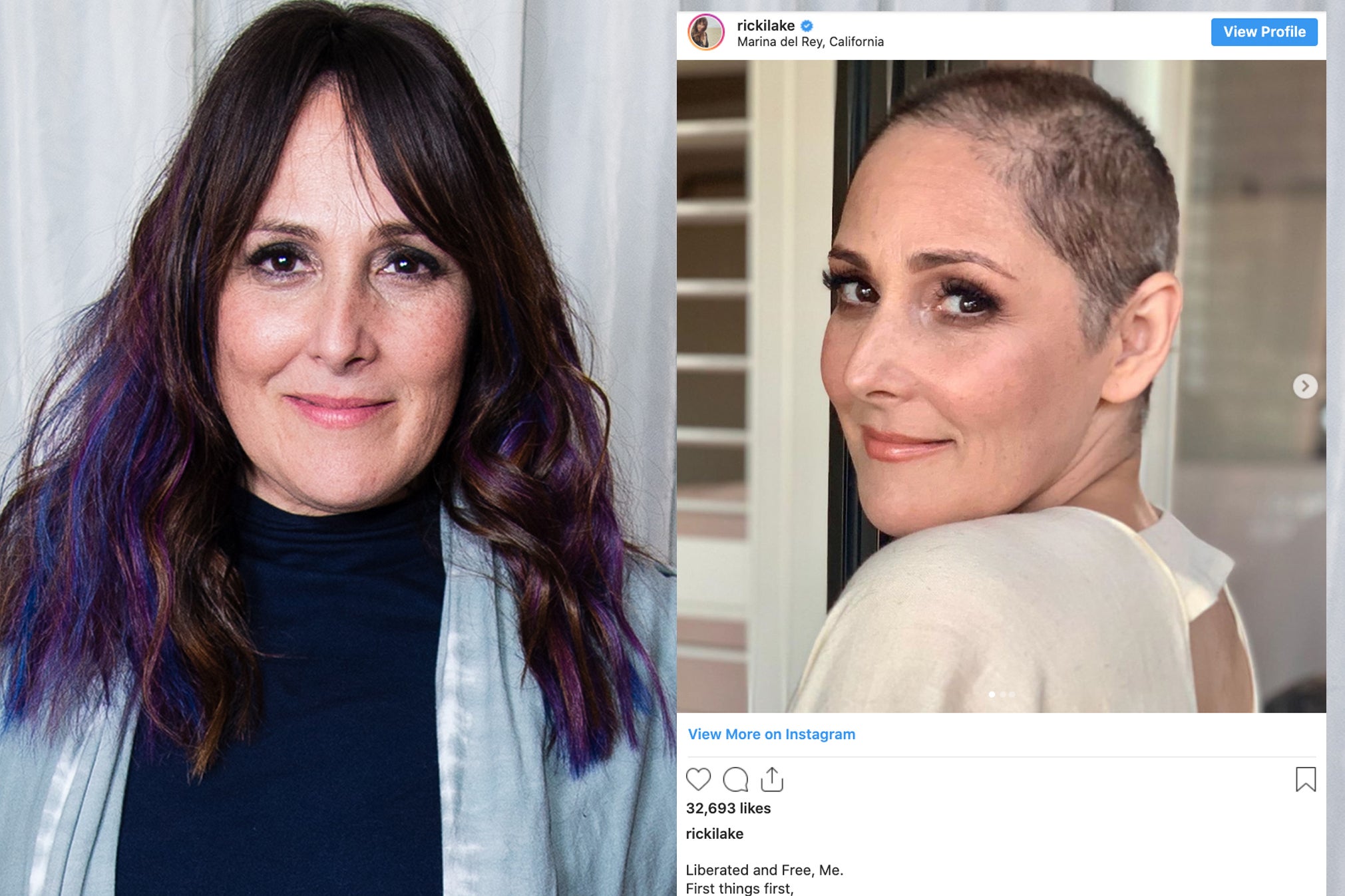 Ricki Lake reveals shaved head after opening up about hair loss (Getty)