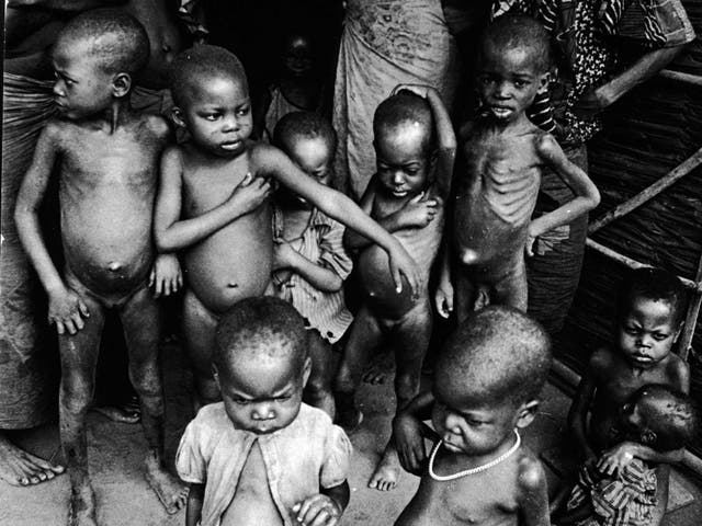 War victims: starving children with distended bellies 
