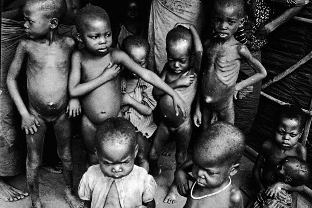 War victims: starving children with distended bellies 
