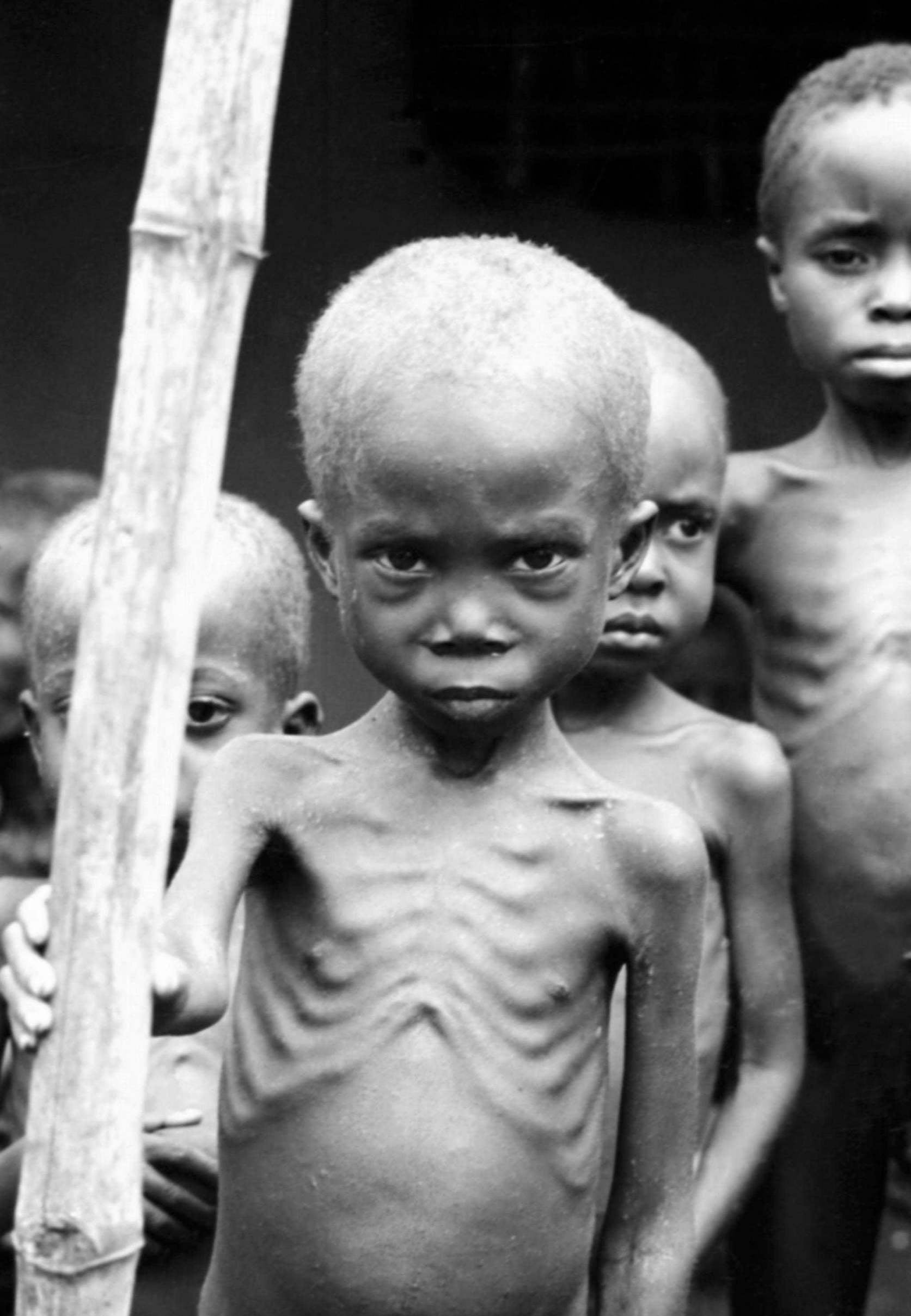 Starvation of Biafrans was a government policy