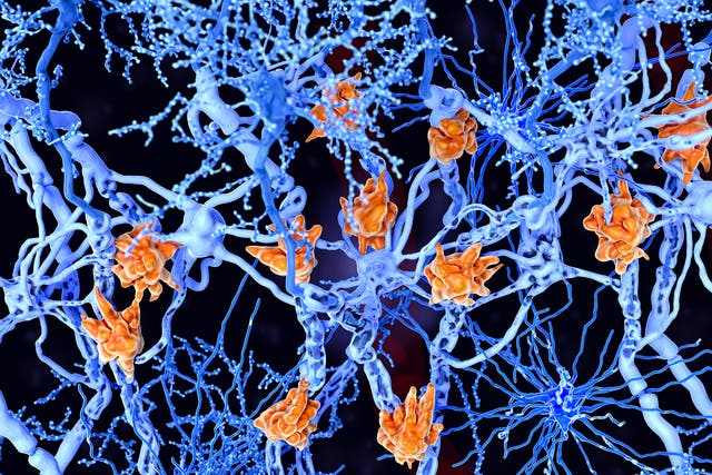 MS sufferers can become disabled because of damage to their nerve cells