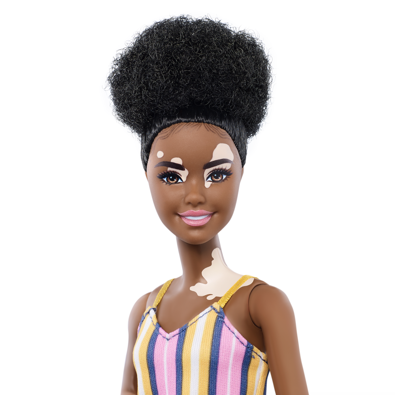 Mattel worked alongside a dermatologist to ensure vitiligo was accurately represented (Mattel)