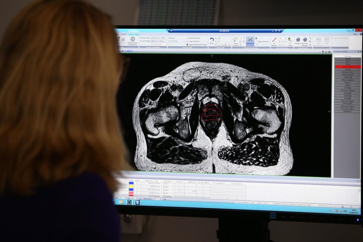 I was diagnosed with prostate cancer – this is what all men need to know