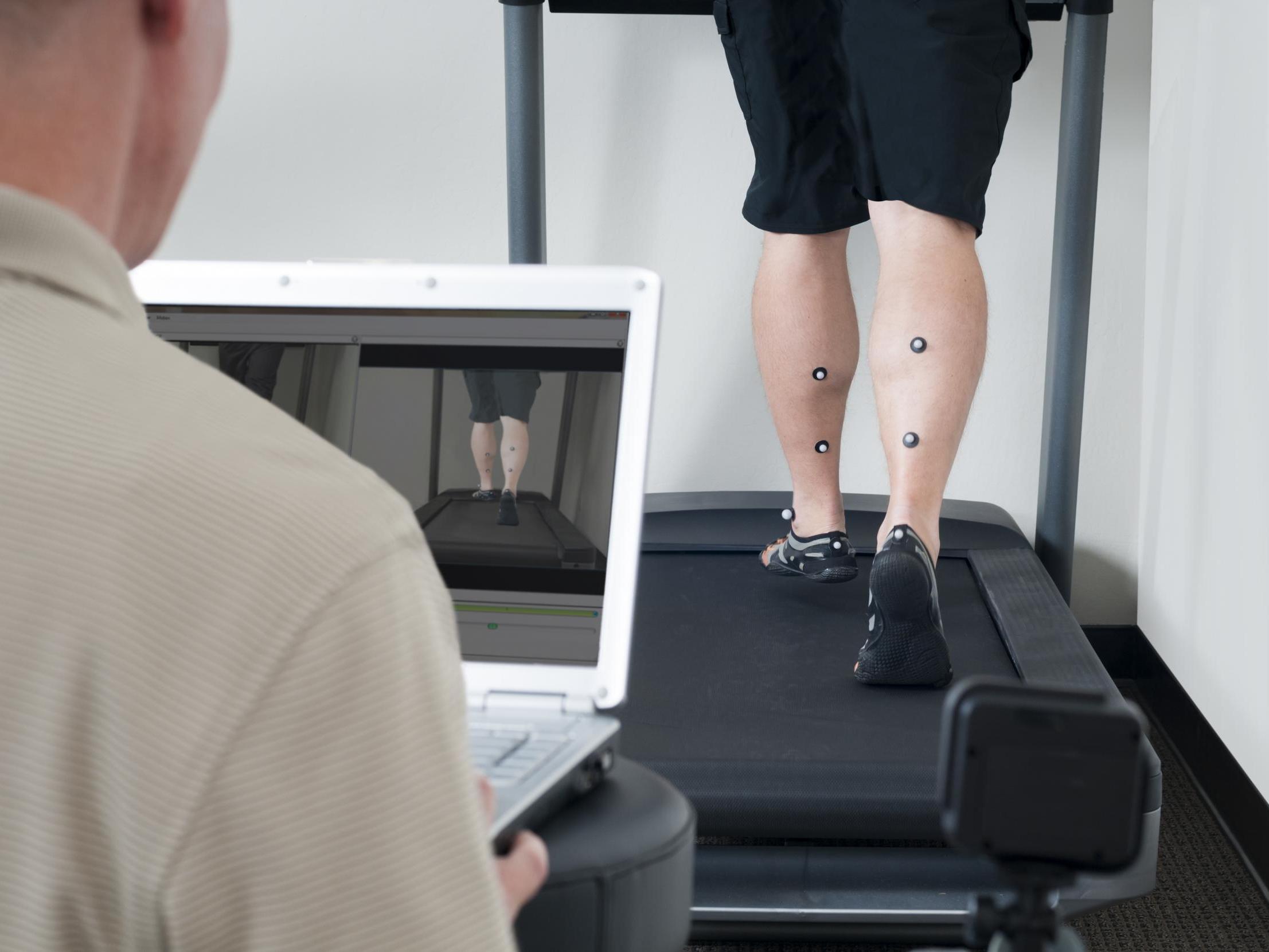 Stock image of gait analysis performed on treadmill.