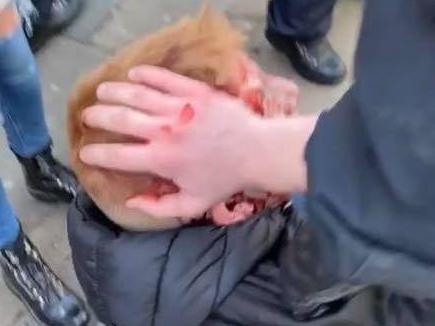 Teenager hit by police baton after football violence &apos;could have been killed&apos;