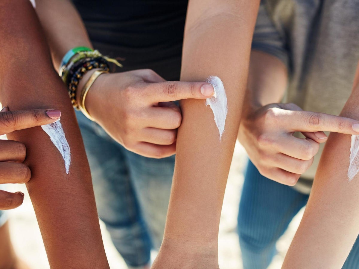 91 Sunburn Couple Stock Photos, High-Res Pictures, and Images - Getty Images