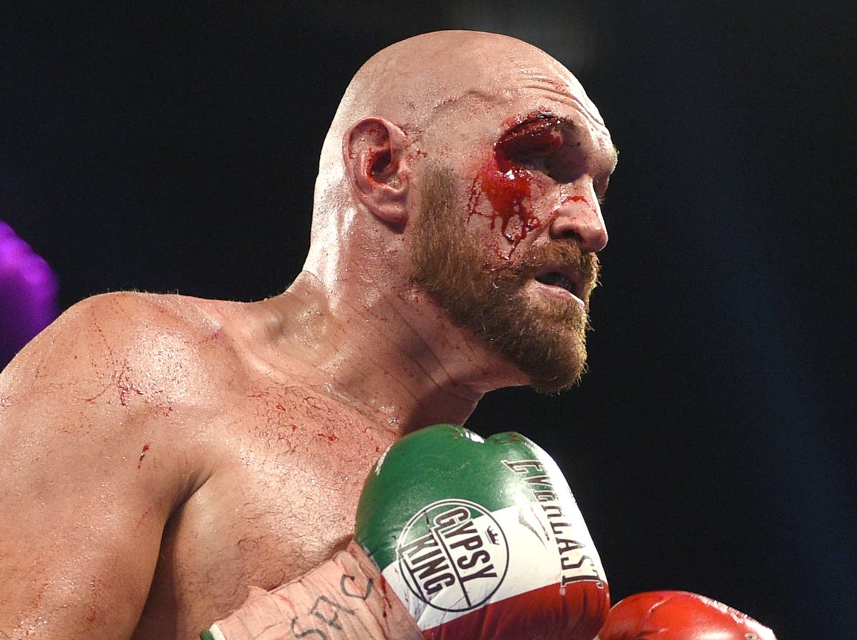 Wilder vs Fury 2: Stitch Duran reveals how challenger plans on avoiding eye injury repeat