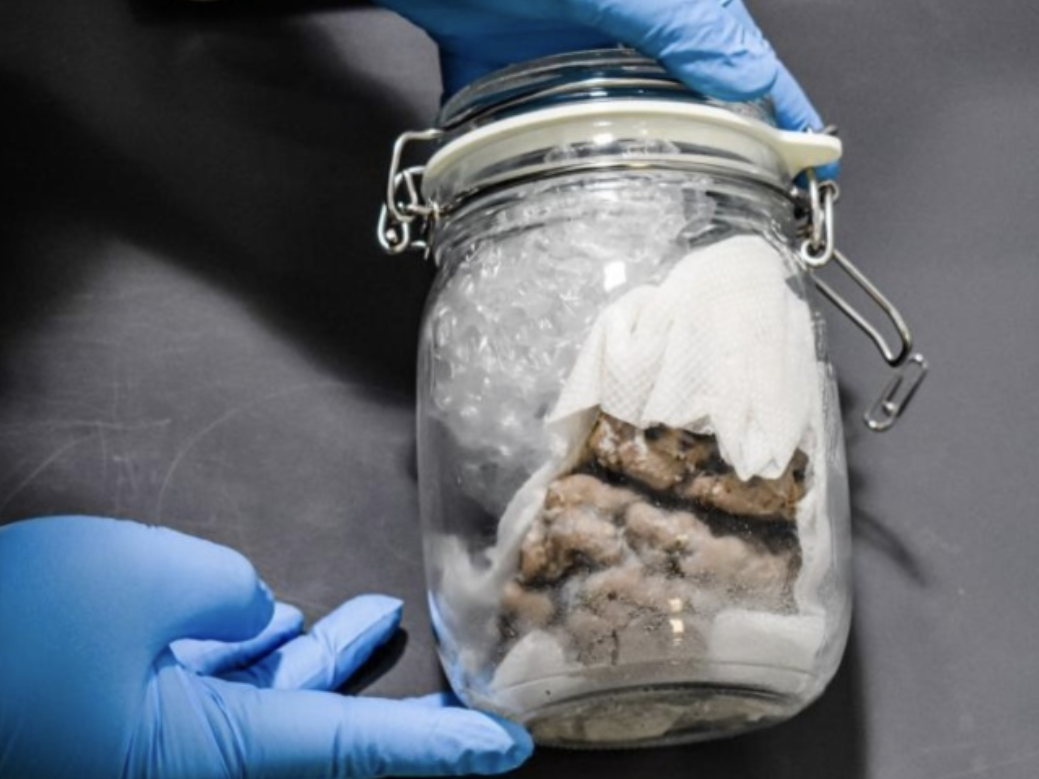 A human brain was seized at the US-Canada border on Friday during a routine mail truck inspection